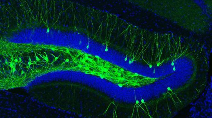ippocampo, neuroni stimolati con la luce